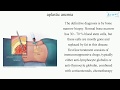 aplastic anemia (English) - Medical terminology for medical students -