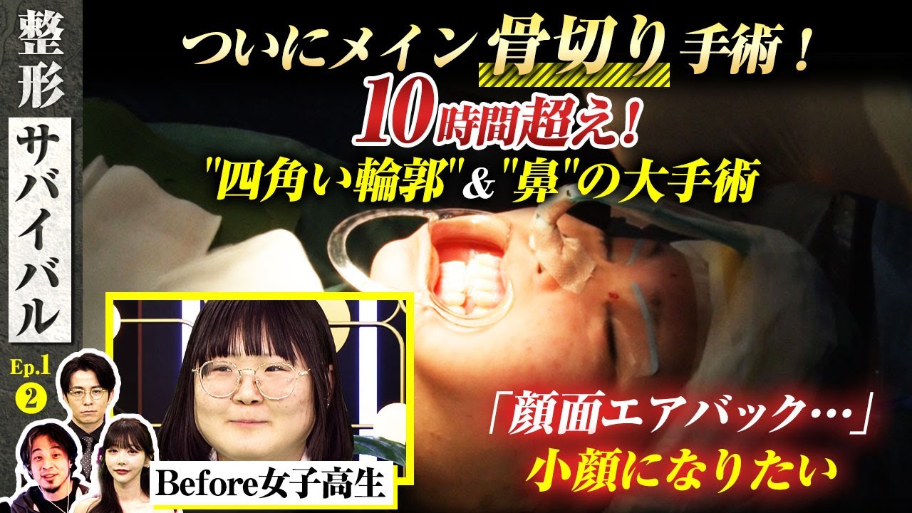 女子高生 ついにメイン骨切り手術！10時間超え！