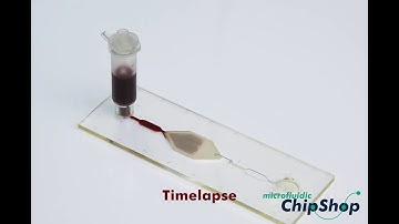 On-chip plasma generation from whole blood