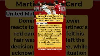 Calvert-Lewin Responds to Lisandro Martinez Red Card Controversy