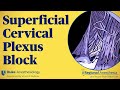 Superficial cervical plexus block