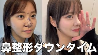 The Plus for Japan | 【鼻形成】👨‍⚕️ジョン先生執刀の鼻の