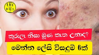 වදකාරී කුරුලෑ නැති කරන්න ලේසිම ක්‍රම 6 ක් | Fixing Acnes | Pimples Clearing Easy Beauty Tips screenshot 3