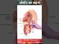 Prostate enlarge | प्रोस्टेट बढ़ना -BPH #shorts #viral #youtubeshorts