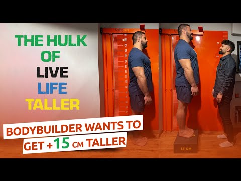 Body Builder wants to get +15 cm taller with limb lengthening surgery | The Hulk of Live Life Taller