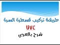 طريقة تركيب القسطرة السرية لحديثي الولادة- Neonatal uvc