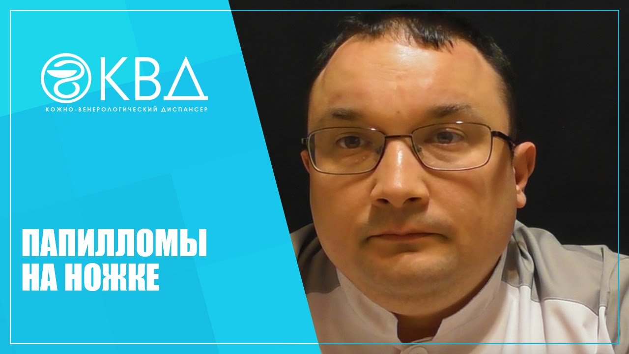 1146 Папилломы на ножке