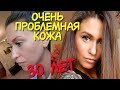 УХОД за ОЧЕНЬ ПРОБЛЕМНОЙ кожей ЛИЦА в 30 лет ✅ УТРЕННИЙ УХОД ЗА ЛИЦОМ 💧 Как сохранить молодость 💜