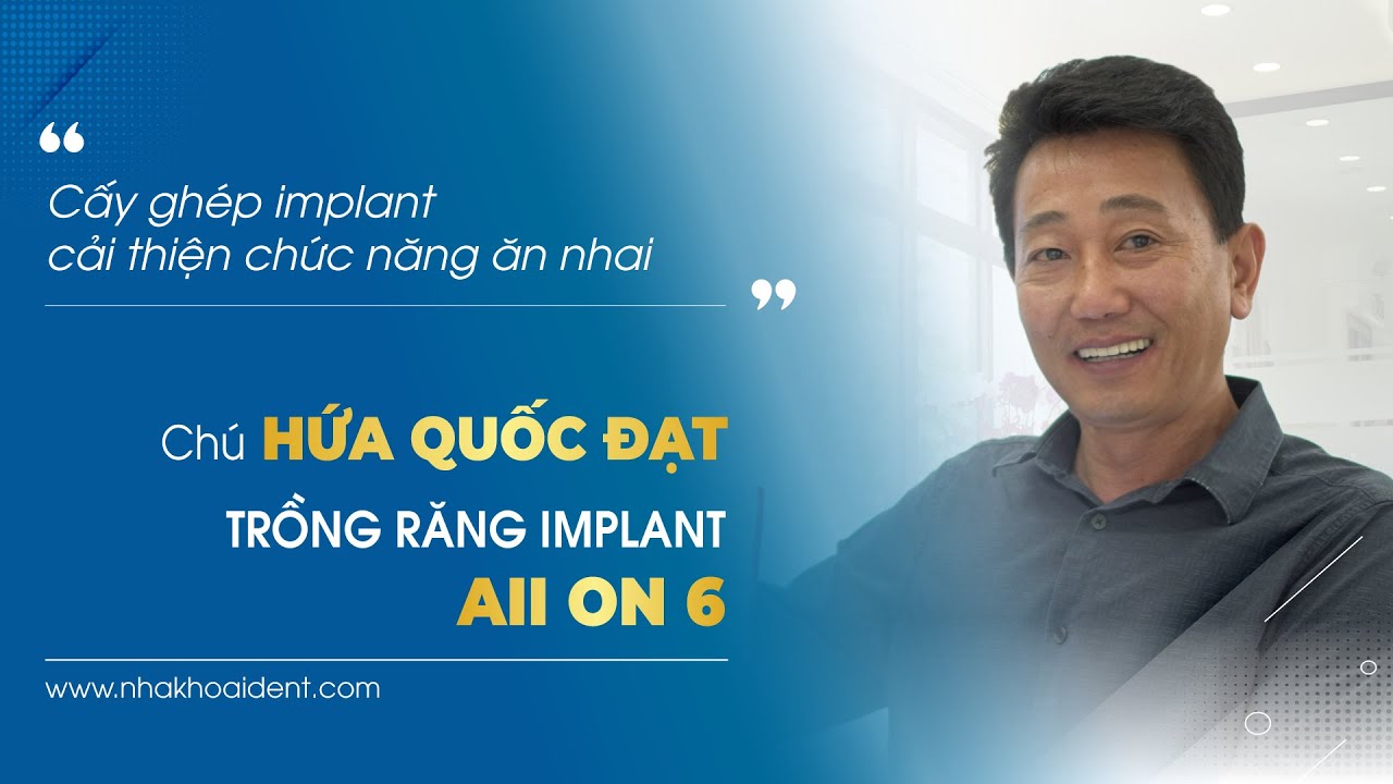 Trồng răng không đau cải thiện ăn nhai | Nha khoa I-DENT