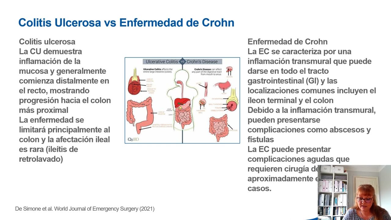 Enfermedad de crohn alimentacion