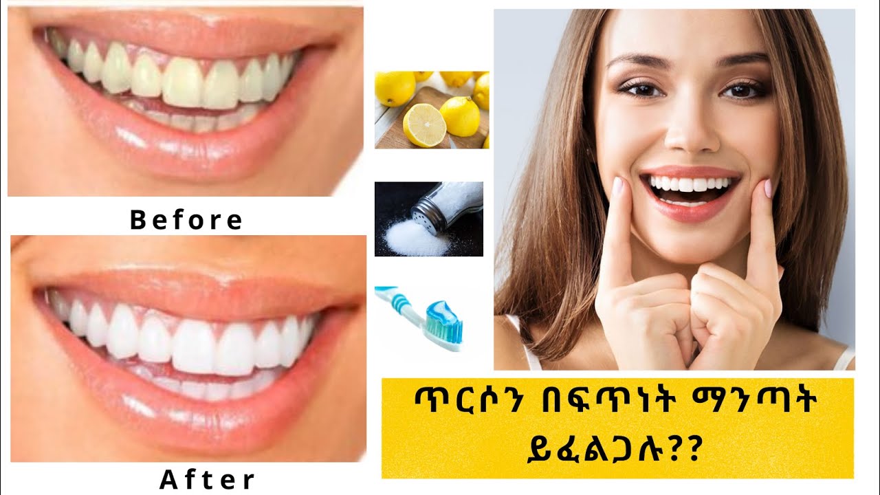 ለጥርስ ንጣት ፈጣን የሆነ መፍትሄ / How to instantly whiten teeth at home YouTube
