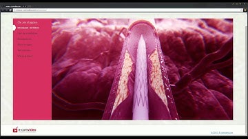 ZORG VIDEO HULP - Interactieve visuele patientencommunicatie voor optimale gedeelde besluitvorming