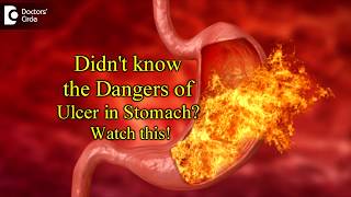 Peptic Ulcer Perforation|Is it life threatening?Symptoms,Treatment-Dr.Nanda Rajaneesh|Doctors Circle