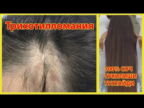 100% SOCH TOʻKILISHI TOʻXTAYDI| SOCH OʻSTIRISH| Волосы больше никогда не будут выпадать!