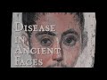 Disease in Ancient Faces