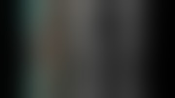 Segmental infected Non Union- Tetra-focal Osteosynthesis