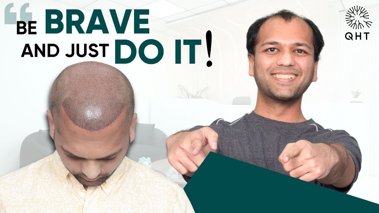 Hair Transplant in Bangalore | Best Results & Cost of Hair Transplant in Bangalore
