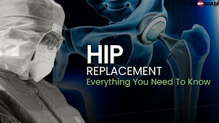 Hip Replacement -Everything You Need To Know @DrdebashishChanda #hipreplacement 