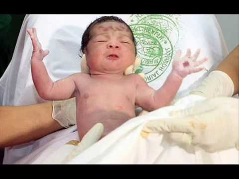 Baby boy born with Jesus Christ’s Stigmata attracts thousands of believers. Is this real or hoax?
