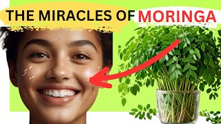 Moringa: Miraculous Power of Moringa Health Benefits| The Ultimate Diabetes Superfood