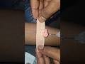 iv cannula proceed #motivation #hospital