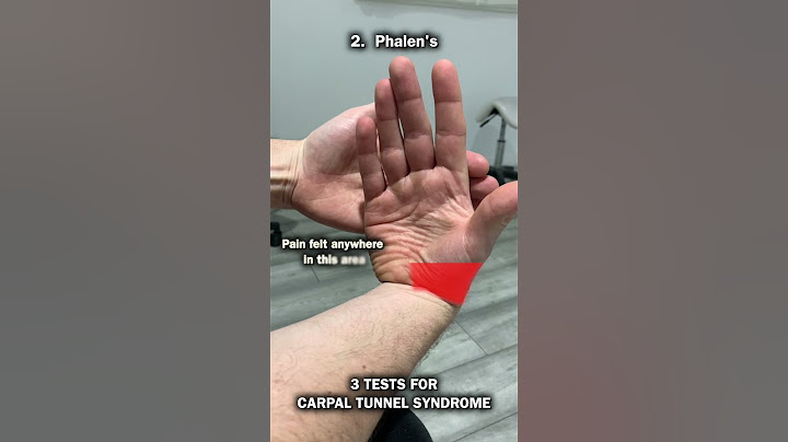 3 Tests For Carpal Tunnel Syndrome!