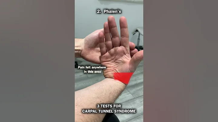 3 Tests For Carpal Tunnel Syndrome!