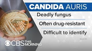 How to protect yourself from the deadly, drugresistant fungus, Candida auris