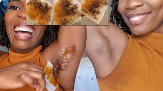 First Brazilian wax‼️tips & tricks  |remove ingrown hair,shave bumps & more