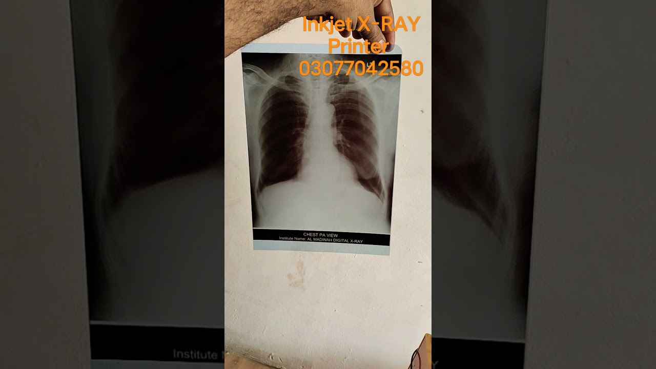 Inkjet X-Ray Printer