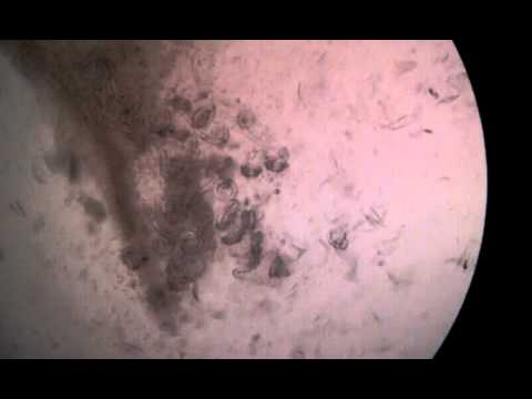 parasitos pulmonares del perro parasitos pulmonares del perro