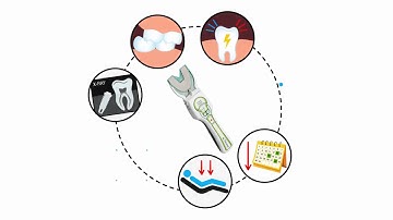 T-Scan: Eliminate Occlusal Guesswork