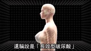 用致癌物為患者隆乳 史亞平夫判賠115萬--蘋果日報 20151013