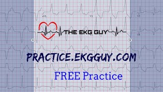 ECG Practice #8 | The EKG Guy - practice.ekgguy.com