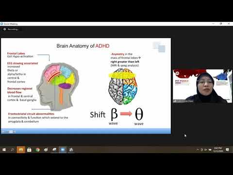 [Terapi] Penjelasan Neurofeedback pada ADHD (Alasan penempatan Elektroda pada Frontal-Sentral Otak)