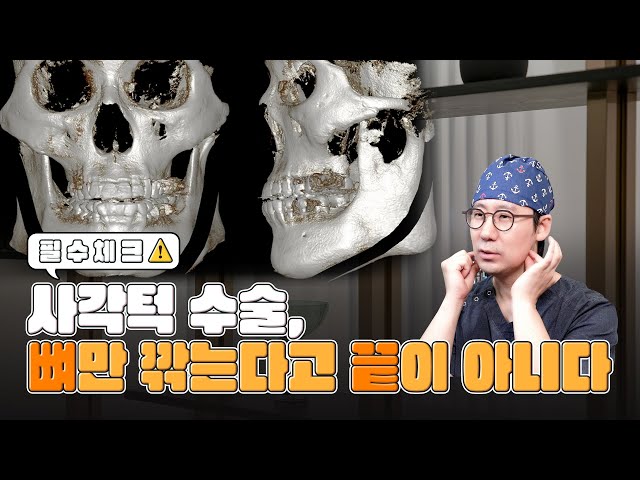 필수체크⚠️ 사각턱 수술, 뼈만 깎는다고 끝이 아니다