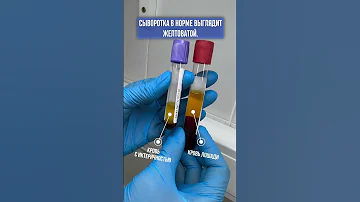 Что такое иктеричность