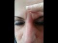 How to remove wrinkles between eyebrows 330-507-9988 internationalglow.jeunesseglobal.com