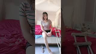 Dalila SAK amputee touching the end of her leg stump
