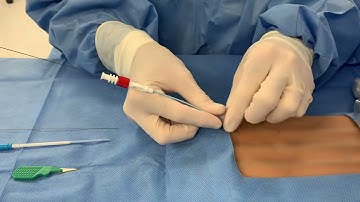MICRO-STICK TO RIC: Ultrasound-guided rapid infusion catheter insertion using a micropuncture kit .