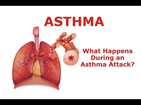 अस्थमा - अस्थमा अटैक के दौरान क्या होता है?