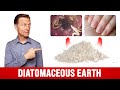 The Benefits of Diatomaceous Earth for Humans