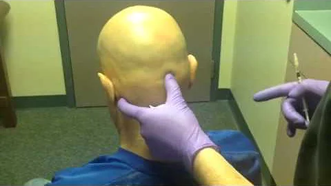 Botox for Migraine by Dr Andrew Blumenfeld