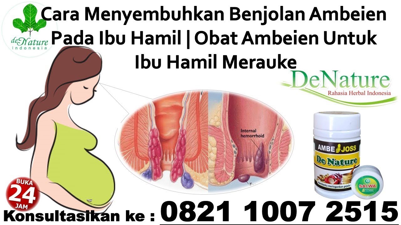 Cara Menyembuhkan Benjolan Ambeien Pada Ibu Hamil | Obat Ambeien Untuk