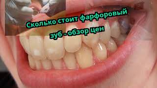 Сколько стоит фарфоровый зуб - обзор цен Сколько стоит фарфоровый зуб - обзор цен