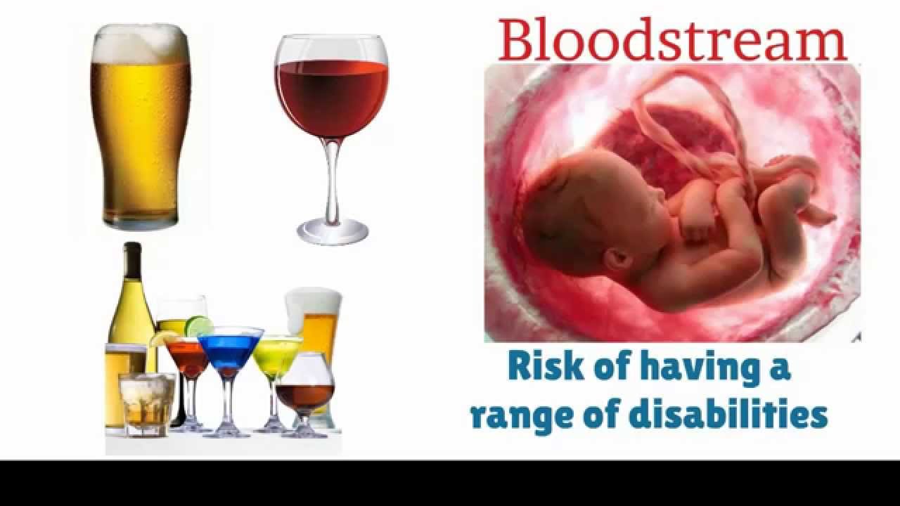 Risks of Alcohol Pregnant - YouTube