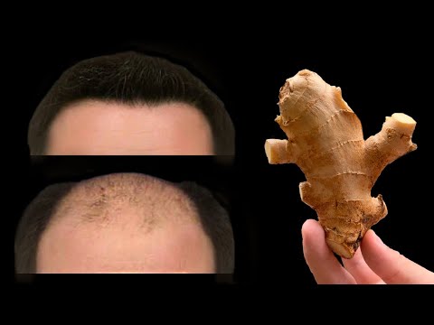 Video: 3 Wege, um deine Haare aus deinem Gesicht zu bekommen