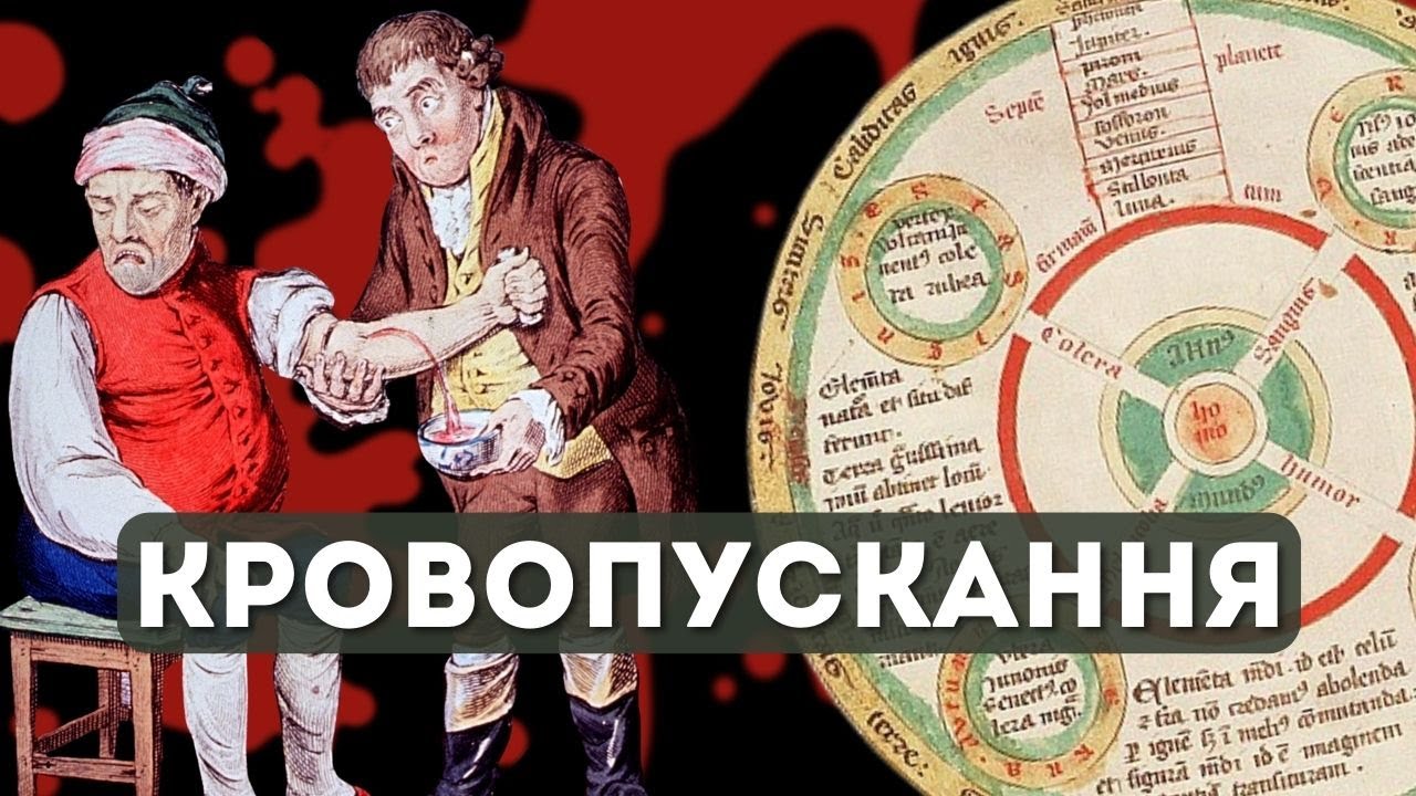 ІСТОРІЯ КРОВОПУСКАННЯ || Чи є сенс у лікуванні лезом та п'явками