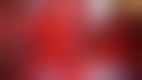 VTI InterFuse S Interbody Fusion Device Insertion Sequence 2