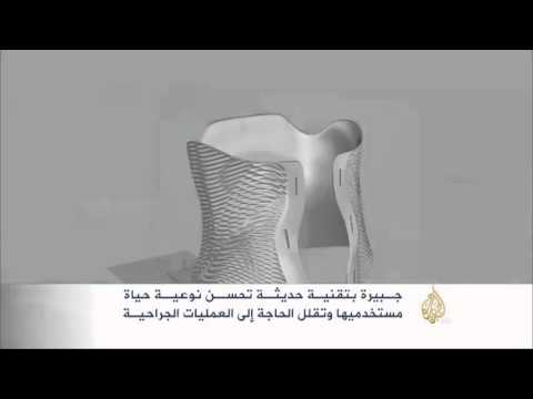 تقنية حديثة تختصر مدة وضع الجبيرة